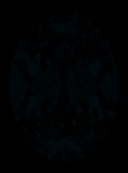 Face-up Fluorescence