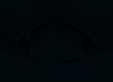 Fluorescence
